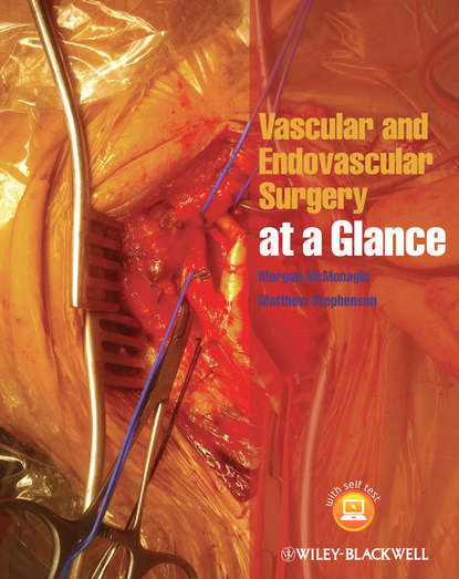 Скачать книгу Vascular and Endovascular Surgery at a Glance